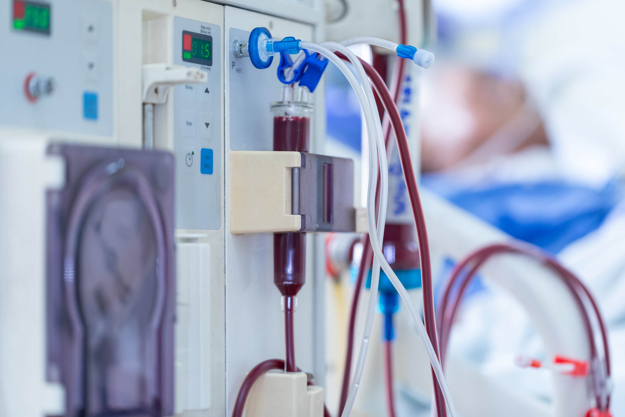 Dialysis fistula and graft management hero image