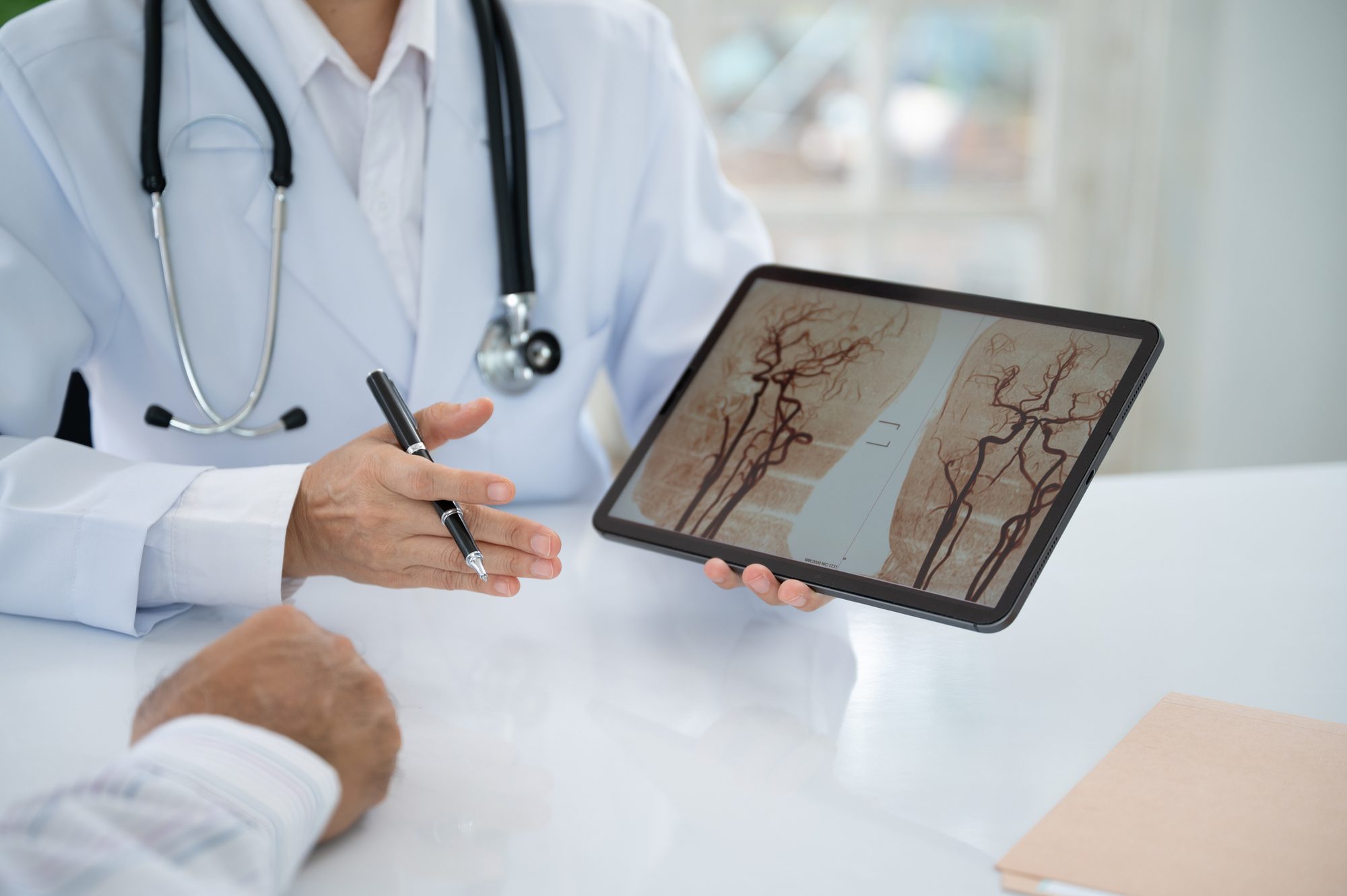 A physician reviewing vascular imaging on a tablet with a patient