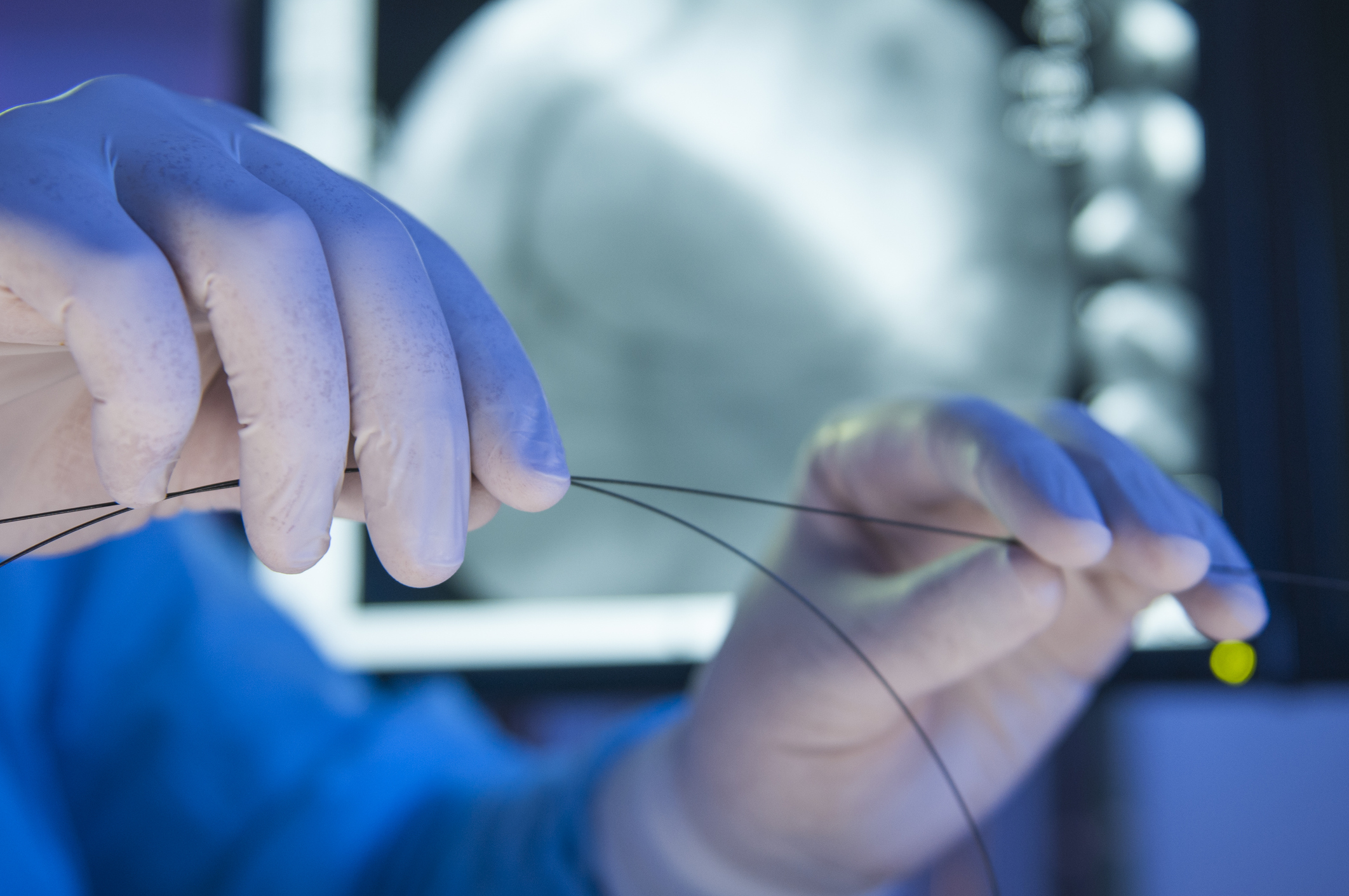 Angioplasty hero image